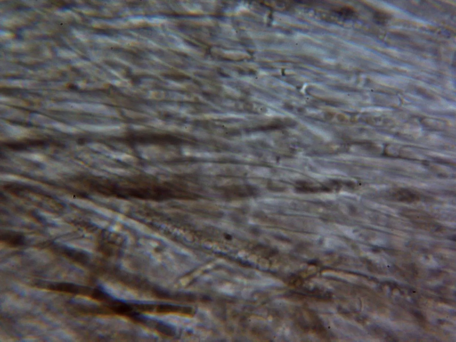 10 - Subpellis agua 1